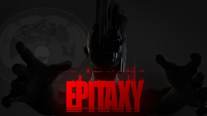 Epitaxy